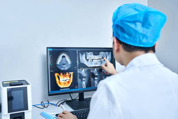 Best Emergency Treatment for Dental Infections or Abscesses in Mount Vernon, MD