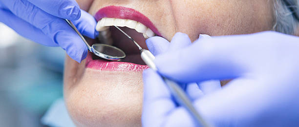 Best Same-Day Emergency Dental Services in Mount Vernon, MD